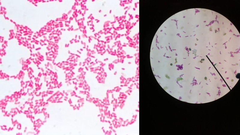 xu-ly-coliform-trong-nuoc-thai-1