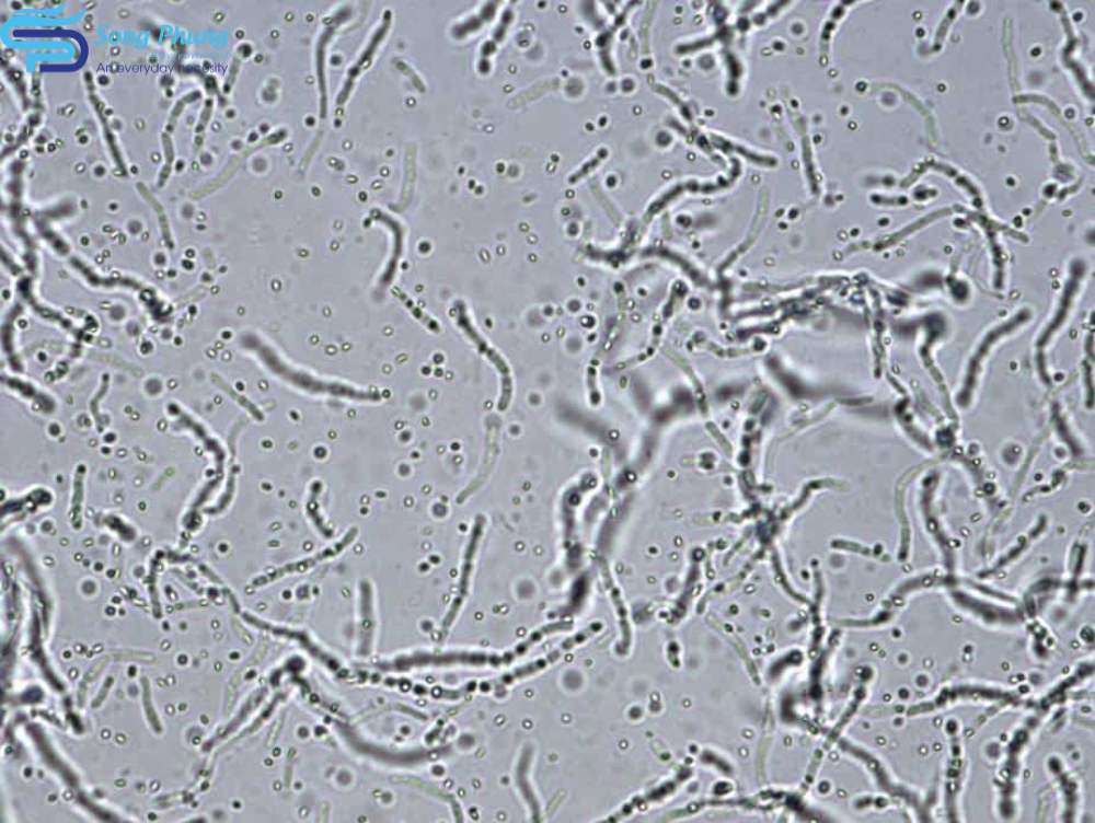 vi-khuan-bacillus-megaterium-2