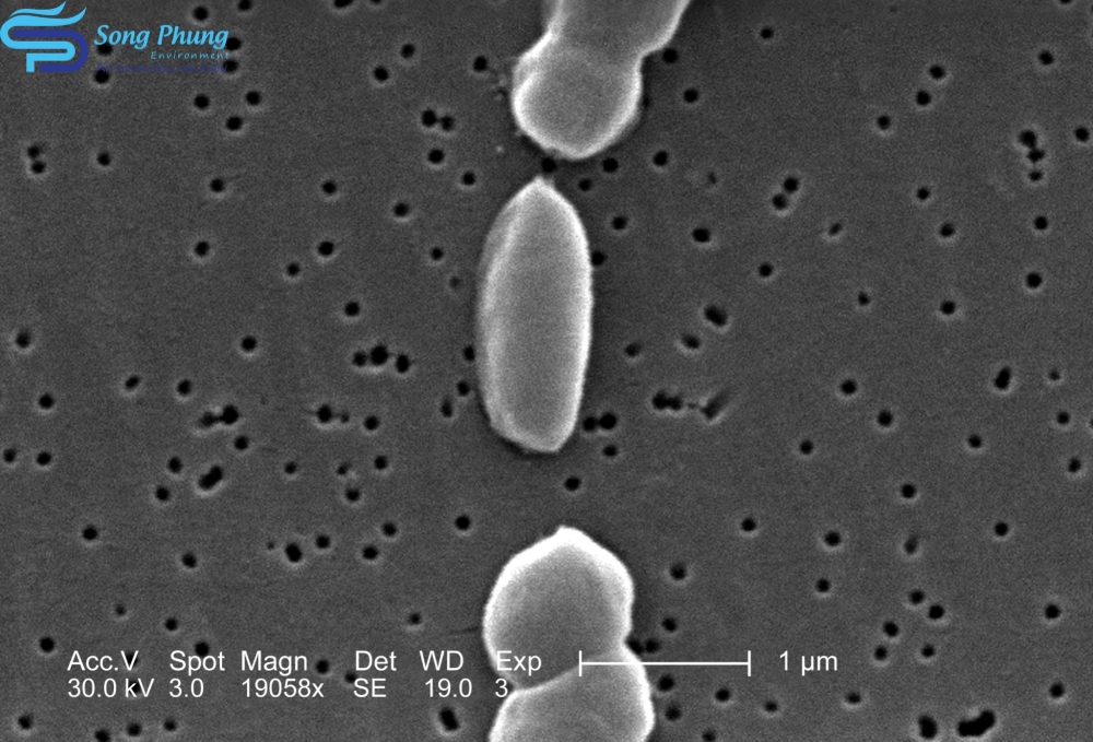 Vi khuẩn Vibrio Parahaemolyticus